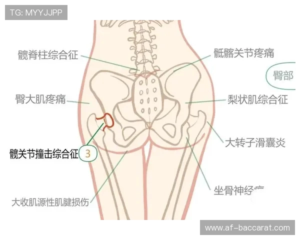 久坐床上玩电脑游戏引发臀部疼痛的原因与缓解方法探讨